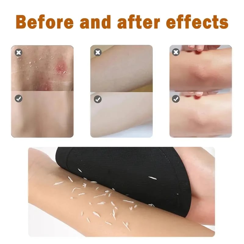 đ§˝ 4-Pack Soft Rubber Shower Scrubber â Gentle Yet Effective, Exfoliates & Cleanses All Skin Types